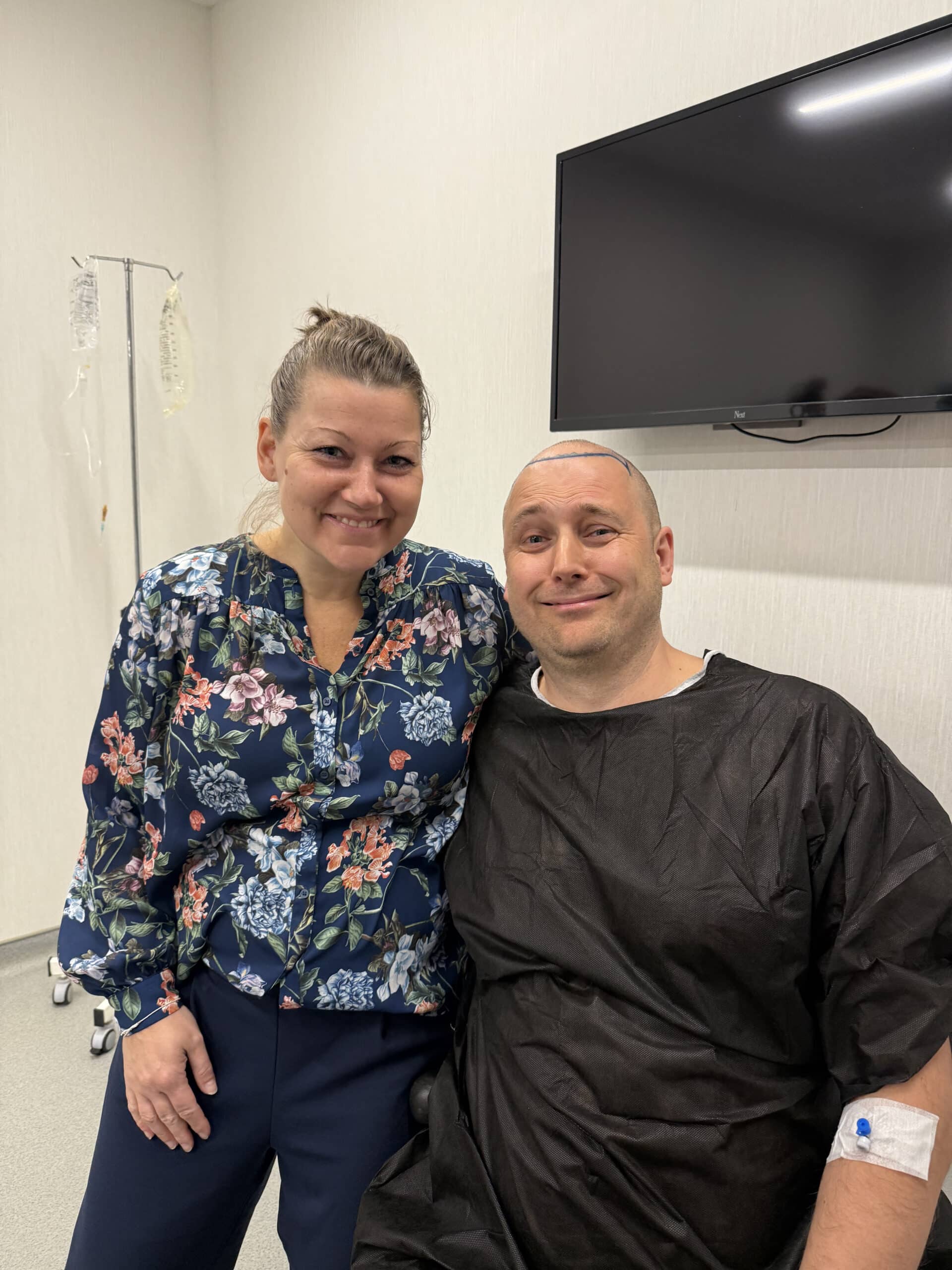 Når kvinder støtter deres mænd i beslutningen om en hårtransplantation